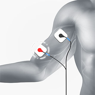 upper arm electrode placement