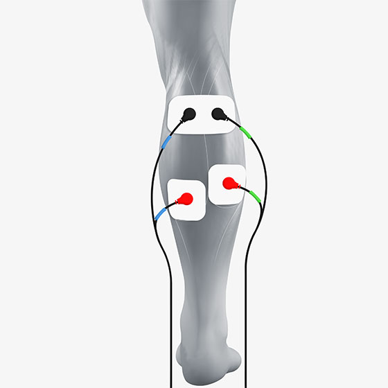 calf electrode placement