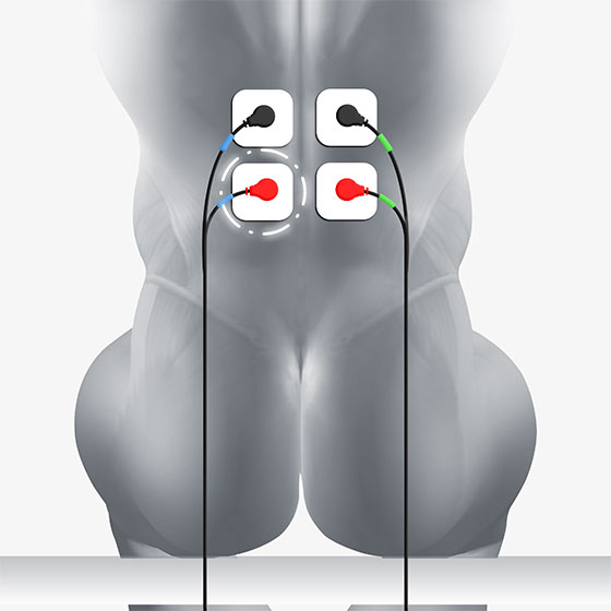 lat electrode placement
