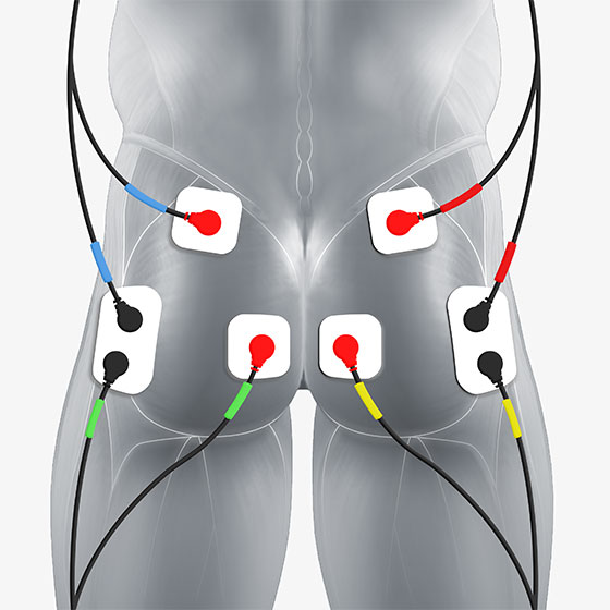 glute electrode placement