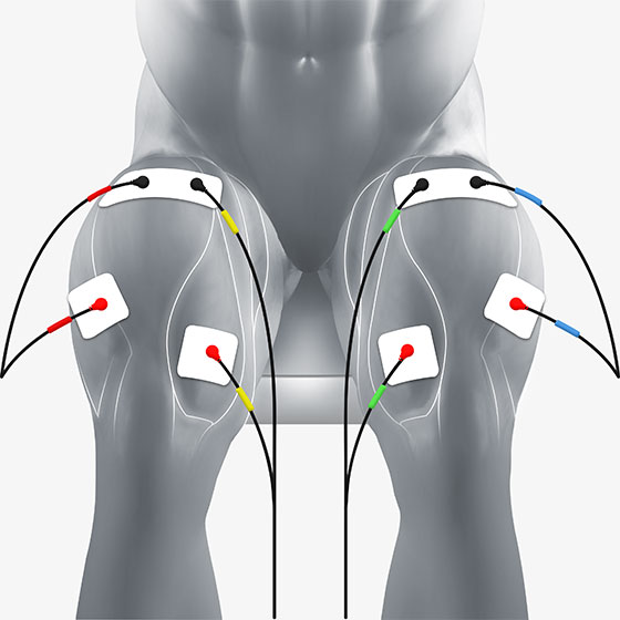 quad electrode placement