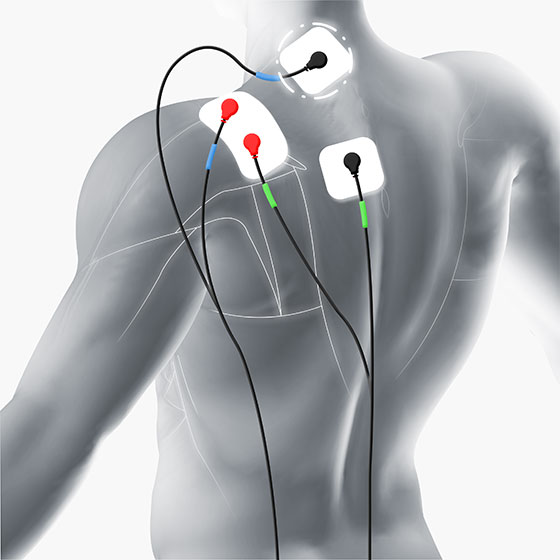 trap electrode placement